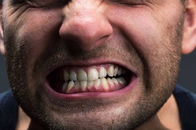 A man clenching and gritting his teeth
